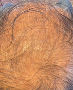 Close-up macro photo of scalp — RUTAM Nº8 Intensive Hair Serum 50ml, follicle nourishment for fine, weak hair