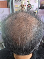 Customer before photo — RUTAM Nº8 Intensive Hair Serum supports overnight self-repair for fine, damaged hair