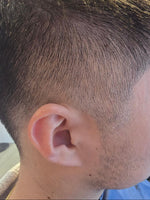 Close-up of male hairline and temple showing thinning hair density – RUTAM Ageless Revitalizing Scalp & Volume Mist supports daily scalp balance and reduces hair shedding at hairline